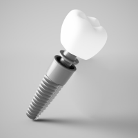 implant